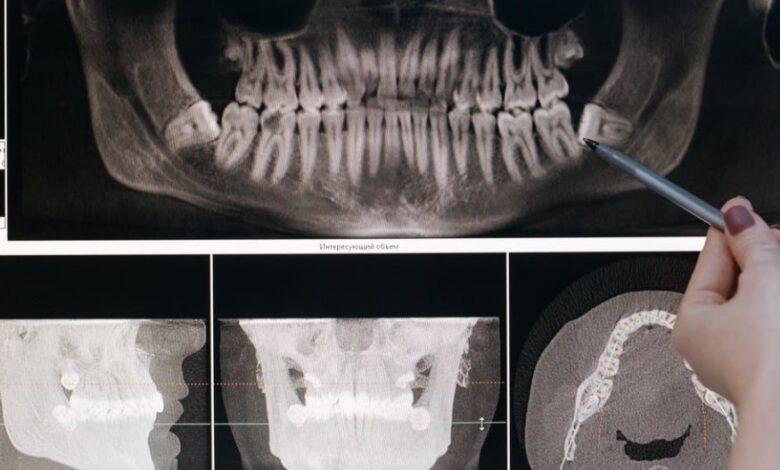 Dental 3D Scanning