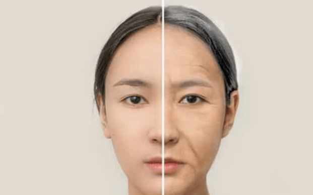 What is Face Grafting and What are its Benefits?